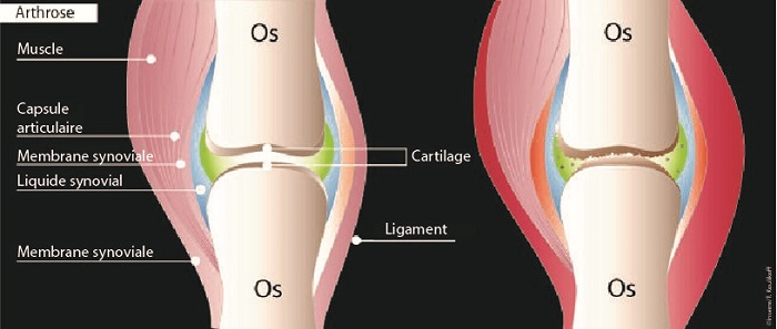 Collagene Articulaire - Arthrose & inflammations - Valebio