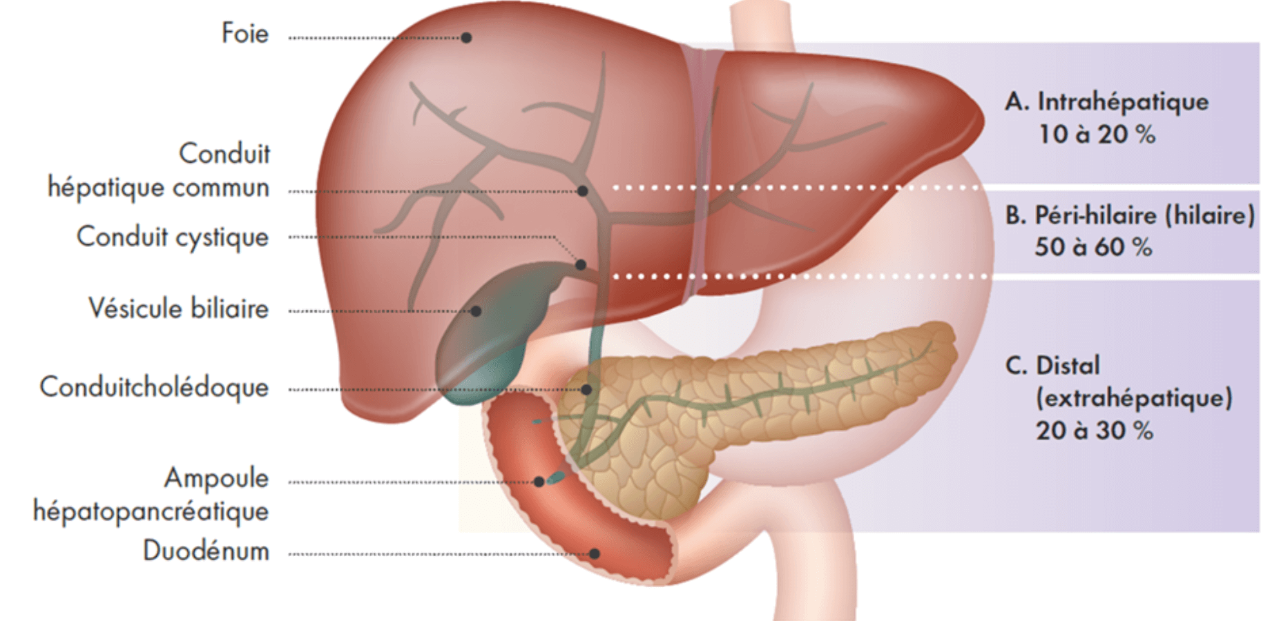 Localisation anatomique et proportion de cas de tumeurs de type cholangiocarcinome attribués à chaque sous-type